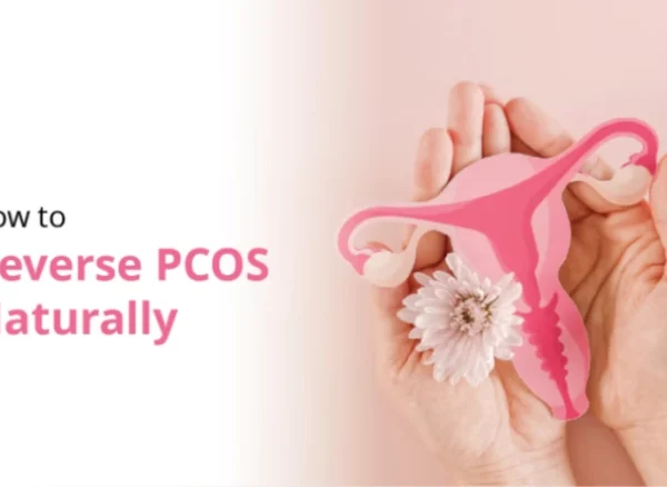 How to reverse PCOS naturally